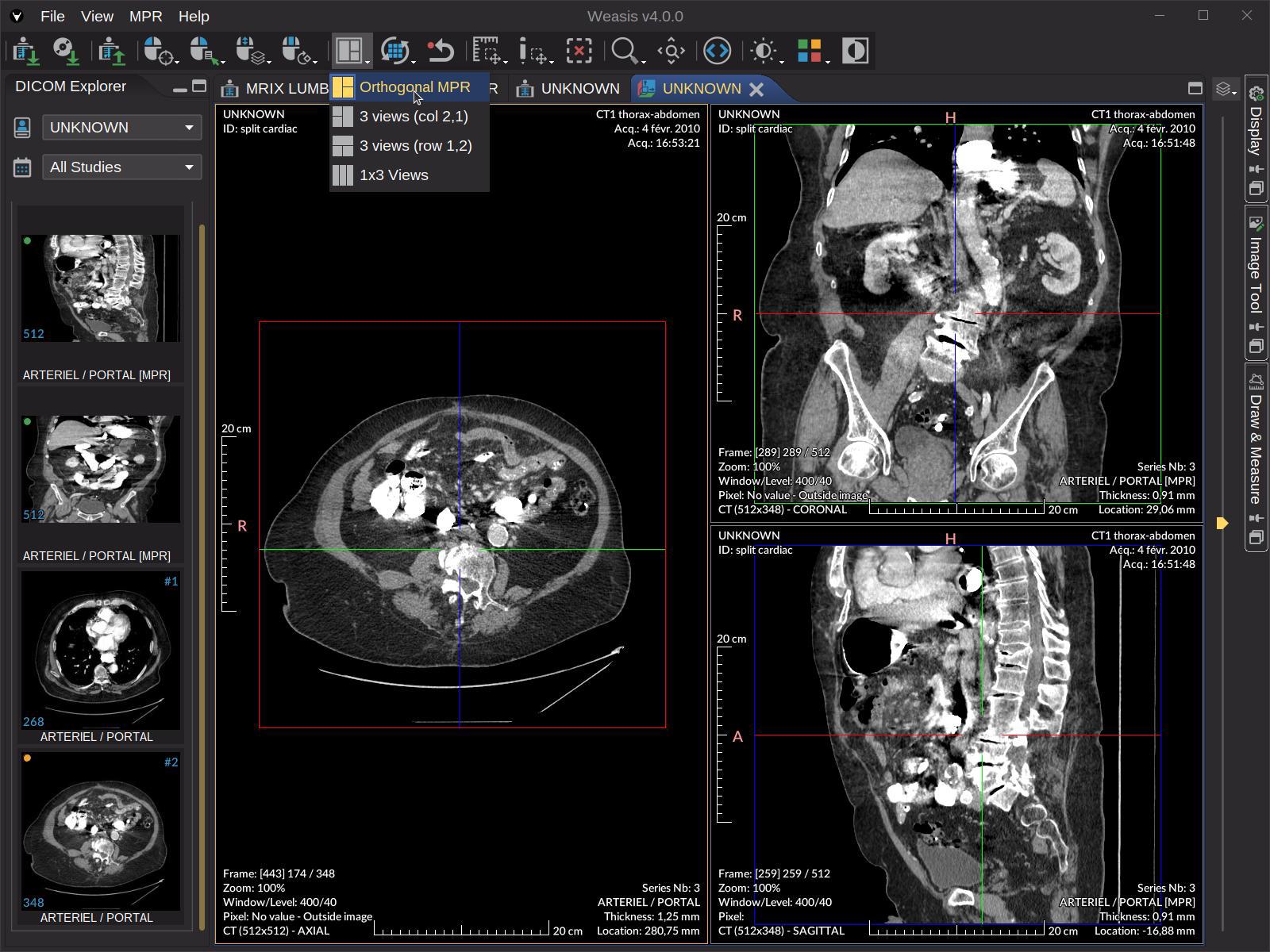 DICOM Medical Imaging Viewer